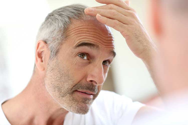 older man hair loss