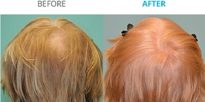 before&after