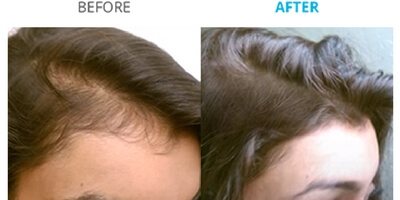before&after