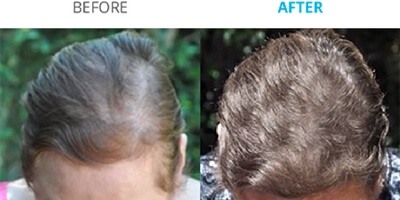 before&after