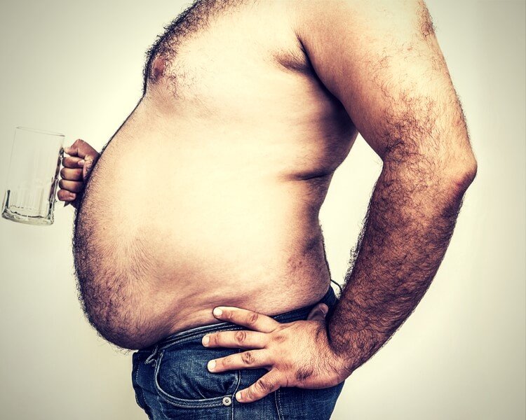 obesity obesity