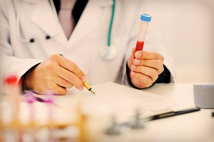 Blood test tube and report illustrating the importance of measuring prolactin before treating elevated levels