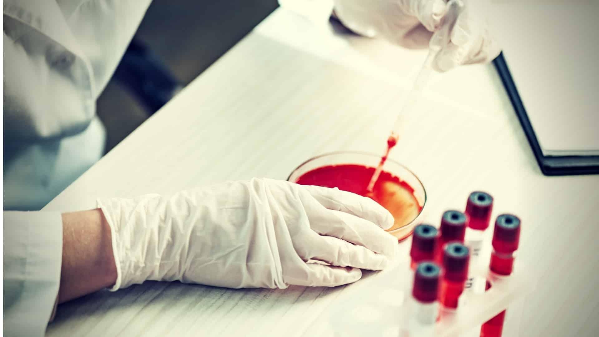 Cropped view of immunologist holding pipette with red liquid in laboratory