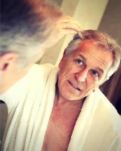 old man hair loss old man hair loss