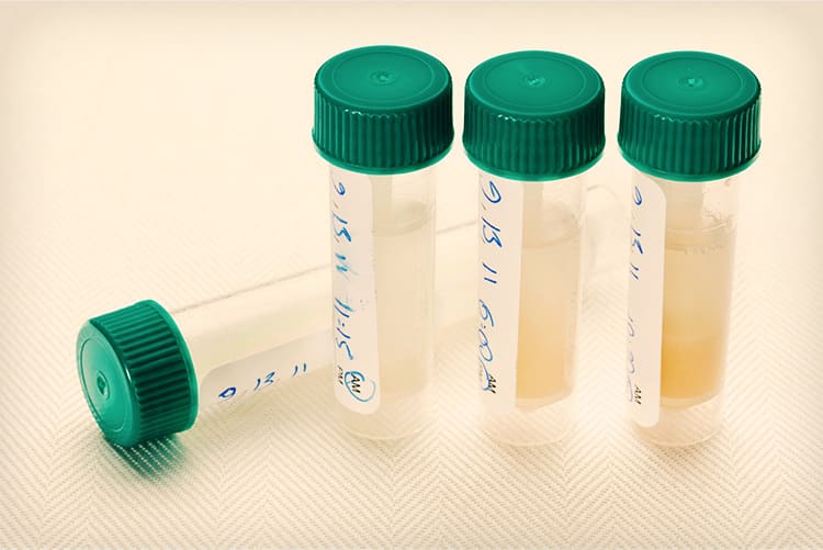 home saliva test
