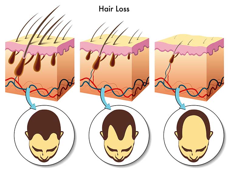 best hair thickening shampoo for men hair loss infographic