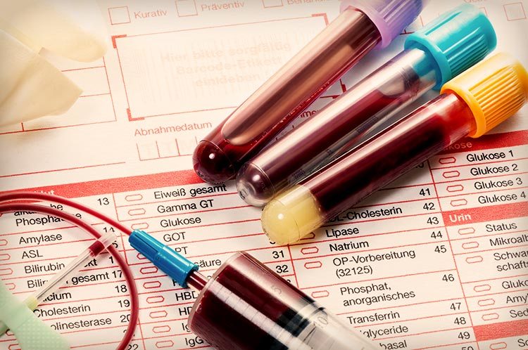 blood test blood test