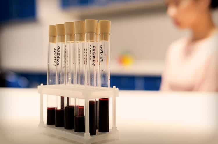 blood tests