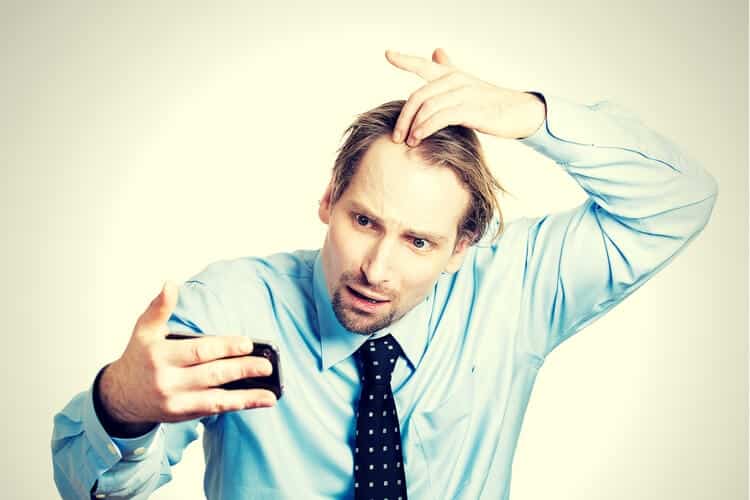 man hair loss man hair loss