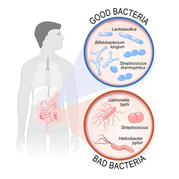 good and bad probiotics