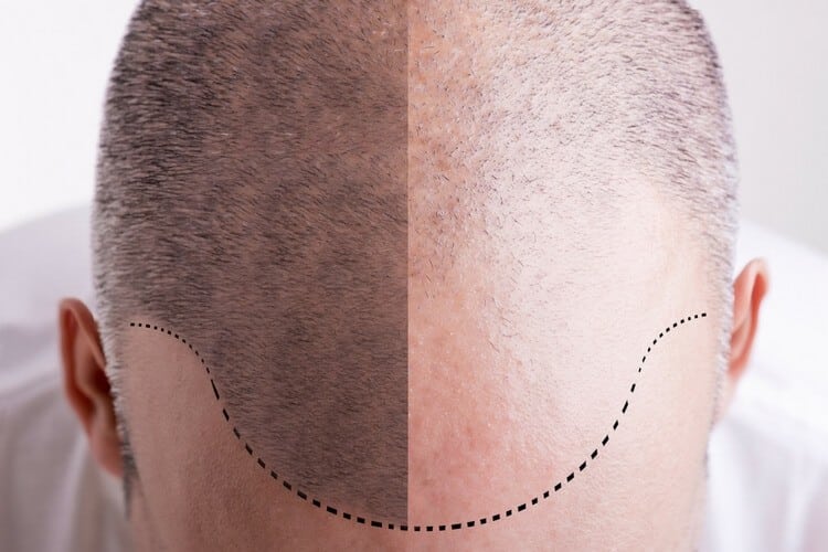 before after before after