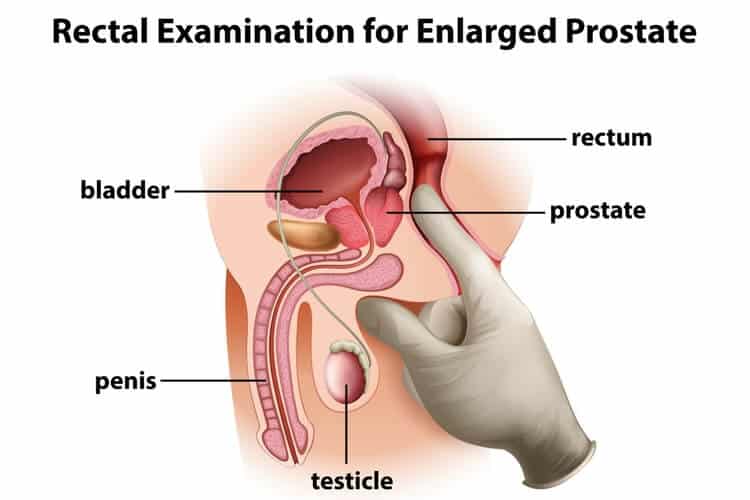 examine